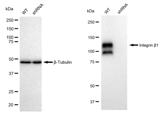 [KD Validated] Anti-ITGB1 Rabbit mAb [72A37B80]