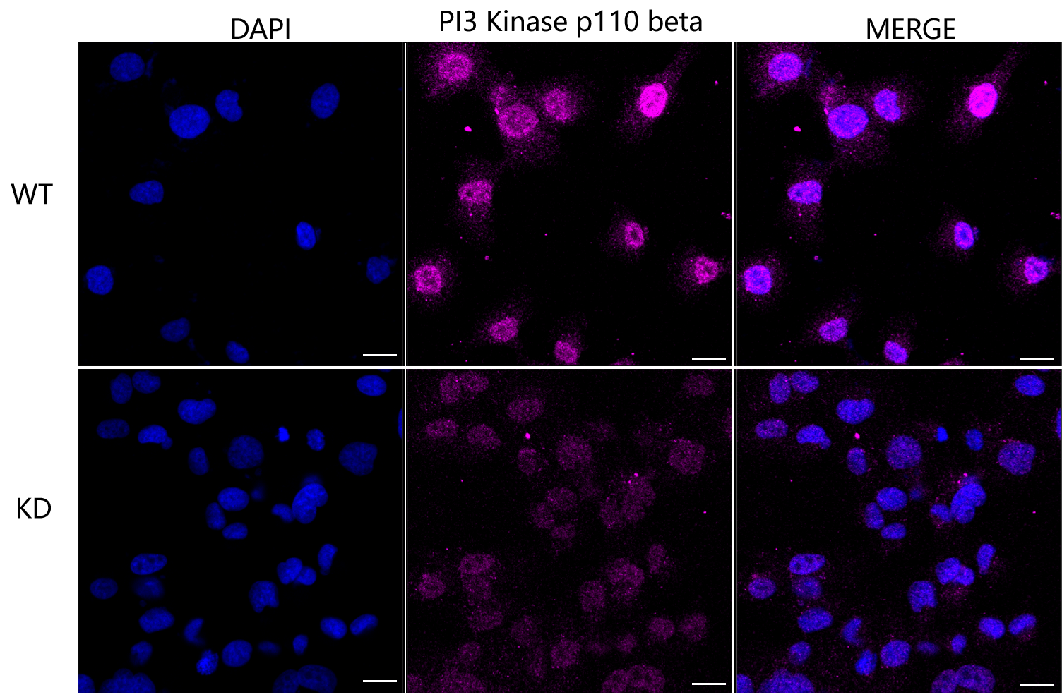 [KD Validated] Anti-PIK3CB Rabbit mAb [72N66Q59]