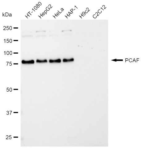 [KD Validated] Anti-KAT2B Rabbit mAb [72A07M30]