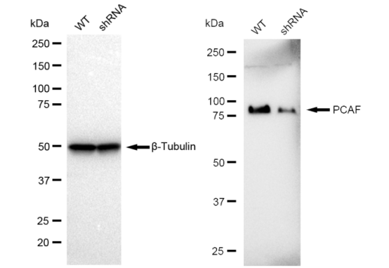 [KD Validated] Anti-KAT2B Rabbit mAb [72A07M30]