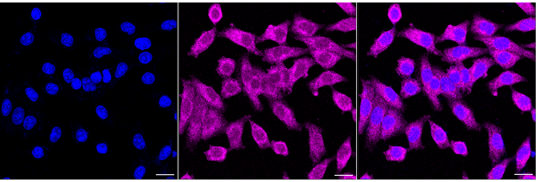 [KD Validated] Anti-CLTC Rabbit mAb [88B48T31]