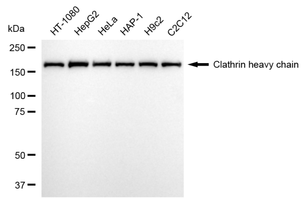 [KD Validated] Anti-CLTC Rabbit mAb [88B48T31]