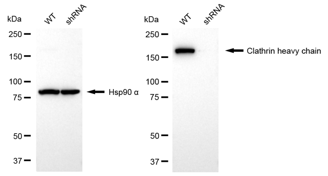 [KD Validated] Anti-CLTC Rabbit mAb [88B48T31]