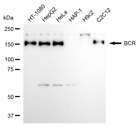 [KD Validated] Anti-BCR Rabbit mAb [29E06S36]