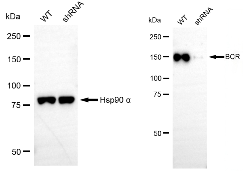 [KD Validated] Anti-BCR Rabbit mAb [29E06S36]