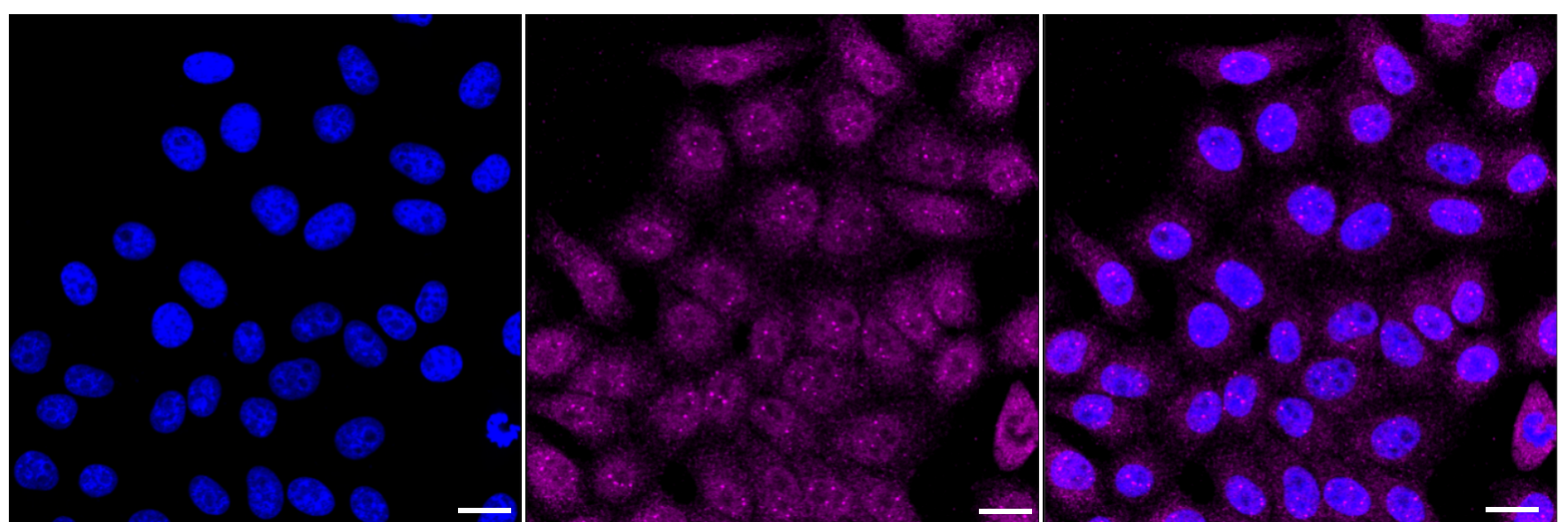 [KD Validated] Anti-GRK2 Rabbit mAb [71G89N11]