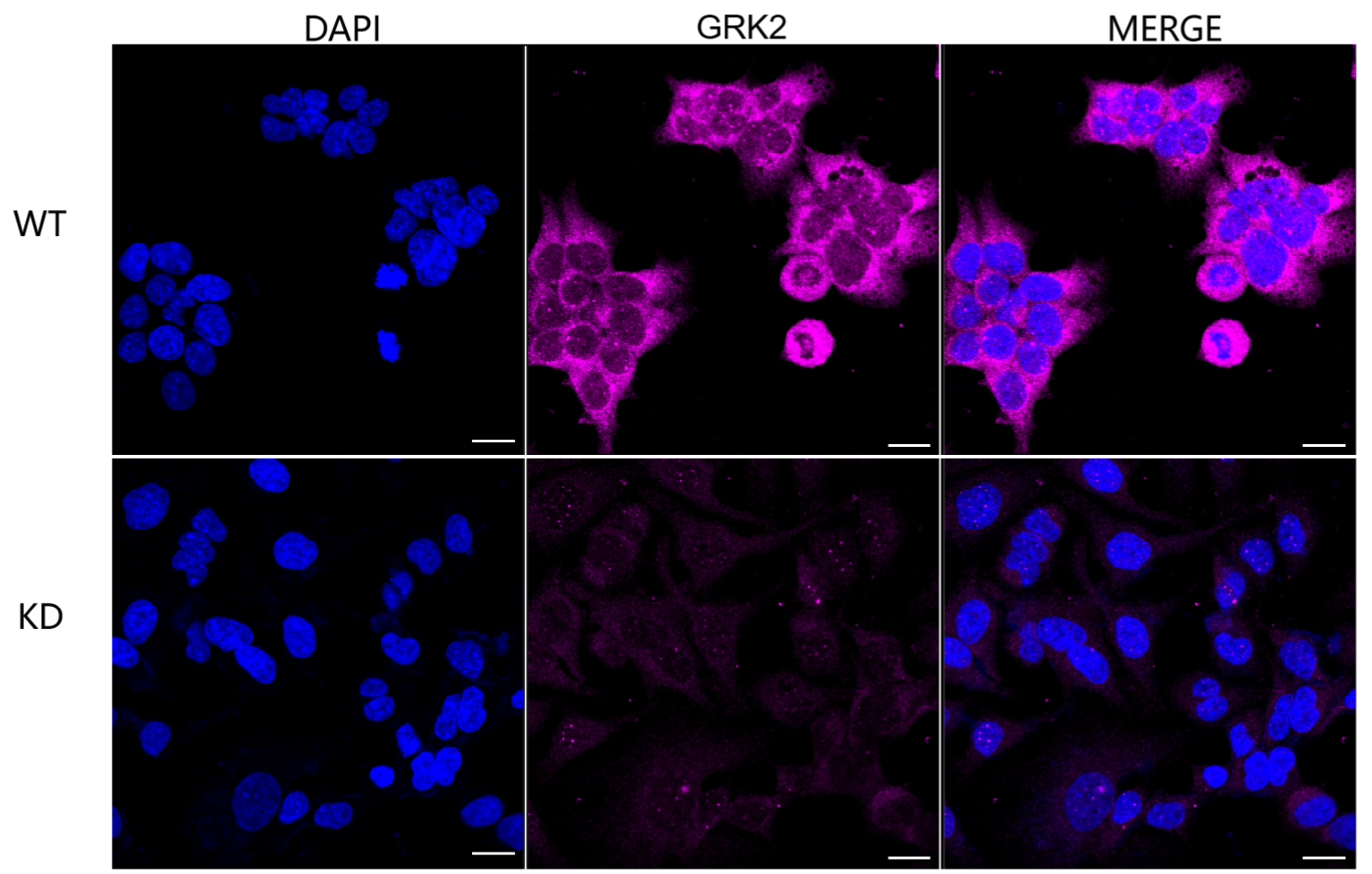 [KD Validated] Anti-GRK2 Rabbit mAb [71G89N11]