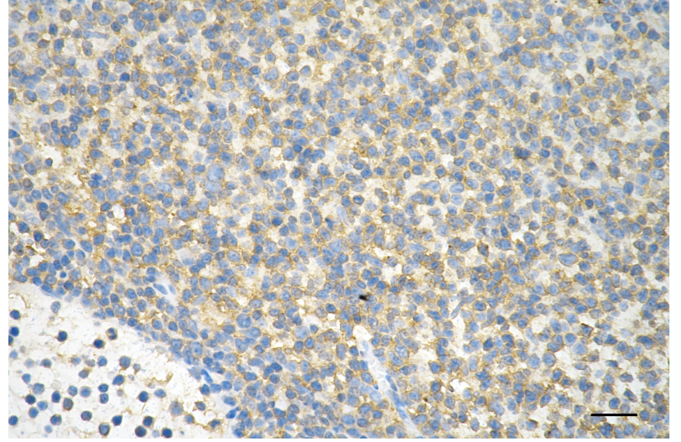 [KD Validated] Anti-GRK2 Rabbit mAb [71G89N11]