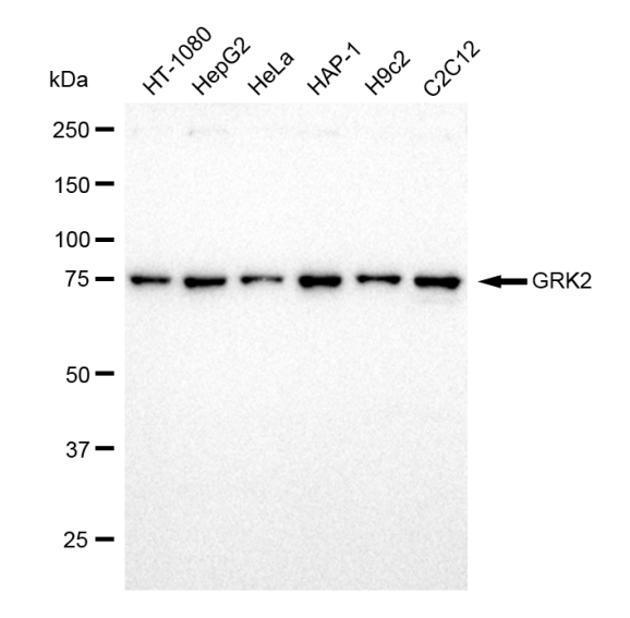 [KD Validated] Anti-GRK2 Rabbit mAb [71G89N11]