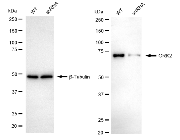 [KD Validated] Anti-GRK2 Rabbit mAb [71G89N11]