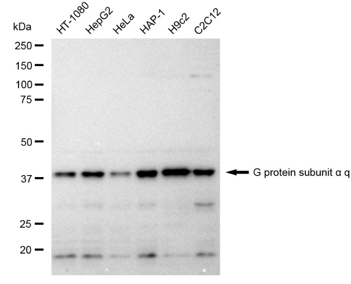 [KD Validated] Anti-GNAQ Rabbit mAb [11S48E33]