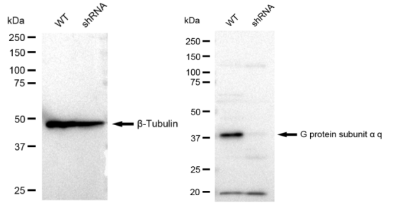 [KD Validated] Anti-GNAQ Rabbit mAb [11S48E33]