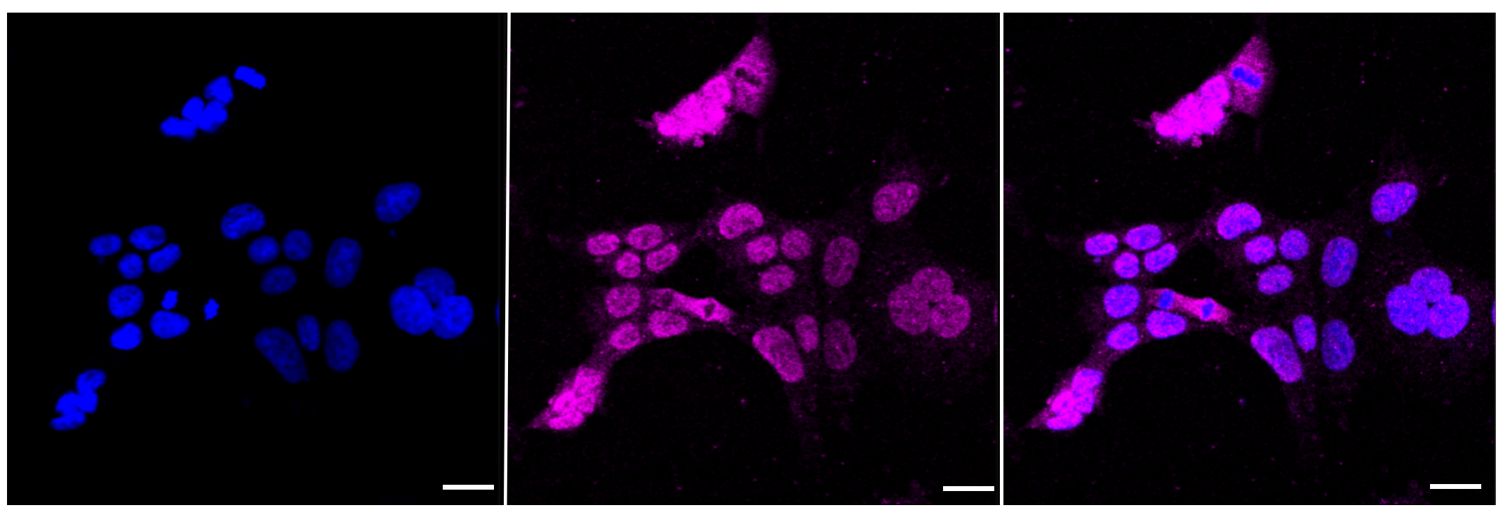 [KD Validated] Anti-IRAK3 Rabbit mAb [96O74D51]
