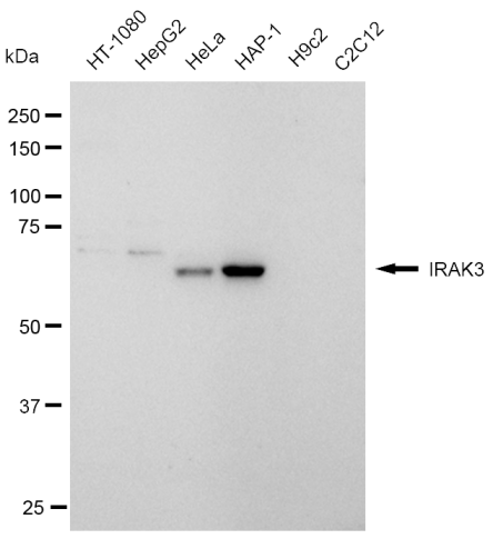 [KD Validated] Anti-IRAK3 Rabbit mAb [96O74D51]