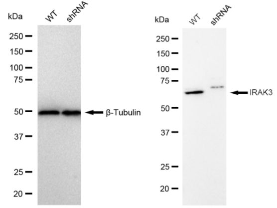 [KD Validated] Anti-IRAK3 Rabbit mAb [96O74D51]