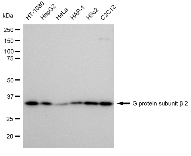 [KD Validated] Anti-GNB2 Rabbit mAb [11J12T61]