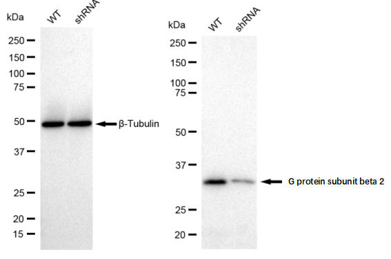 [KD Validated] Anti-GNB2 Rabbit mAb [11J12T61]