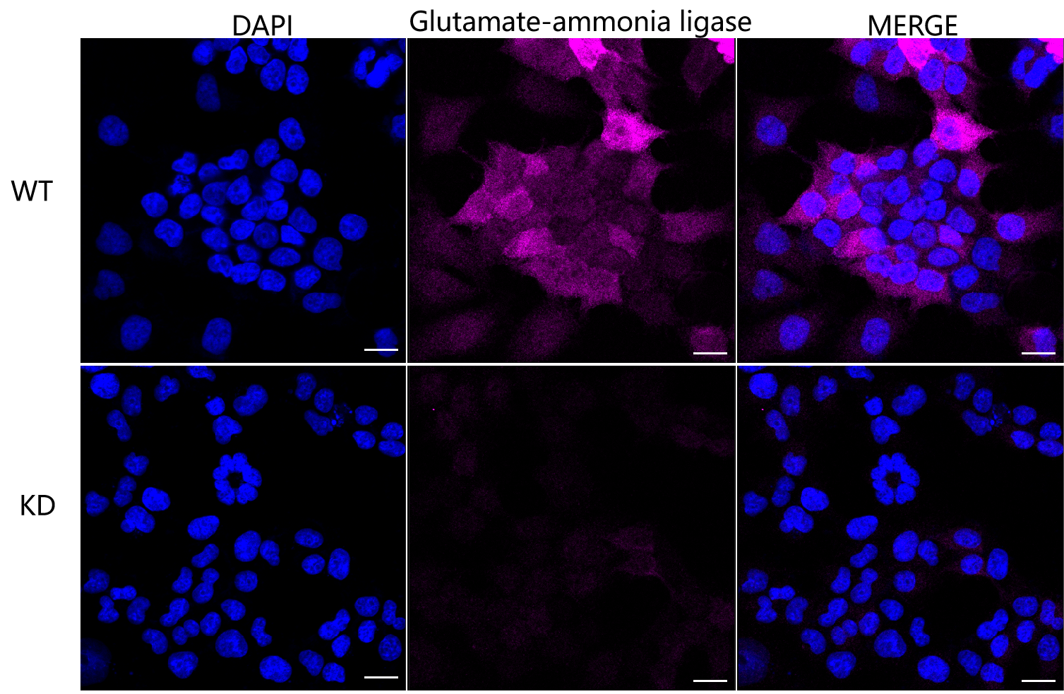 [KD Validated] Anti-GLUL Rabbit mAb [92T65T21]