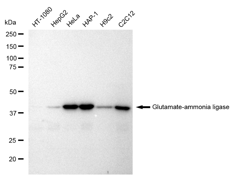 [KD Validated] Anti-GLUL Rabbit mAb [92T65T21]