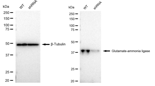 [KD Validated] Anti-GLUL Rabbit mAb [92T65T21]