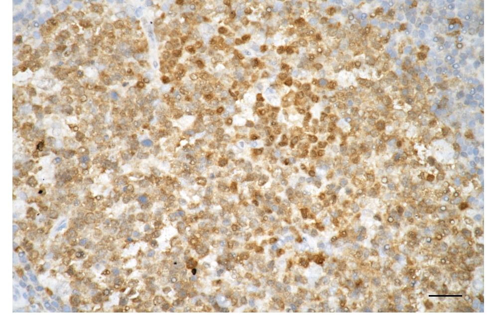 [KD Validated] Anti-CASP3 Rabbit mAb [69E96O15]