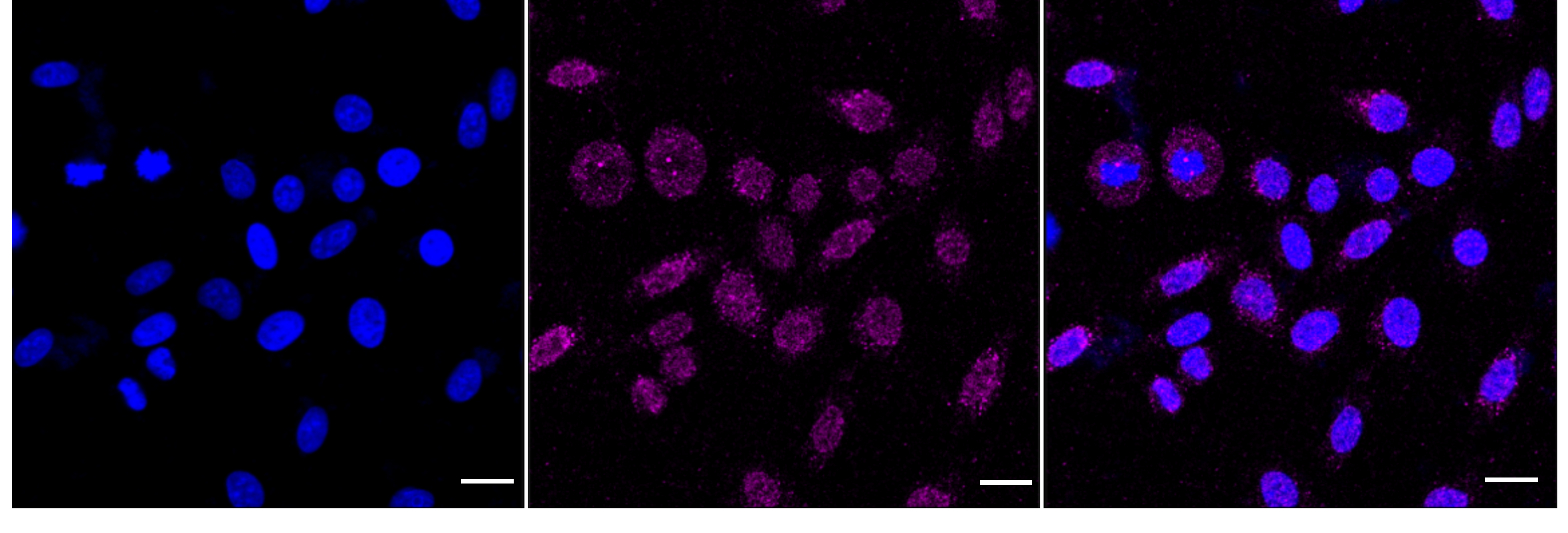 [KD Validated] Anti-ALPP Rabbit mAb [27A48Q79]