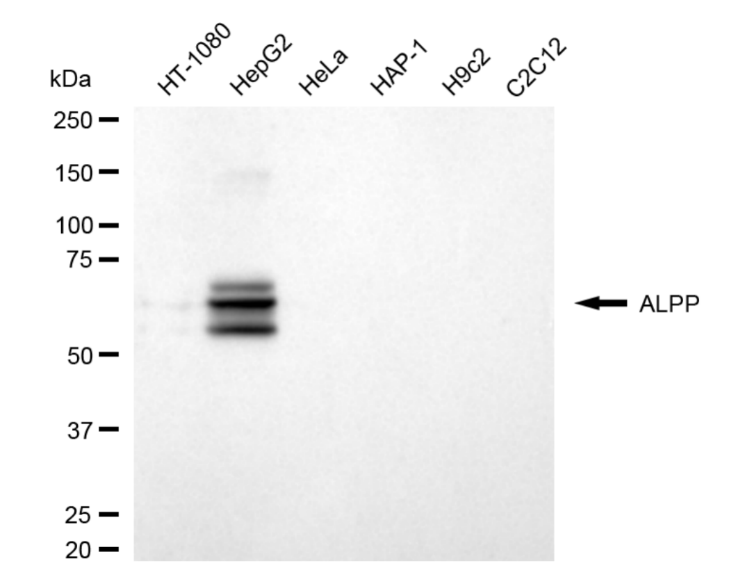 [KD Validated] Anti-ALPP Rabbit mAb [27A48Q79]