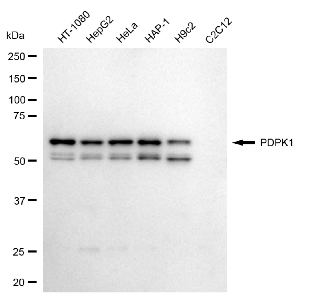[KD Validated] Anti-PDPK1 Rabbit mAb [88S53N34]
