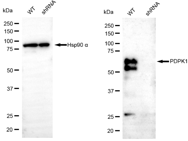 [KD Validated] Anti-PDPK1 Rabbit mAb [88S53N34]