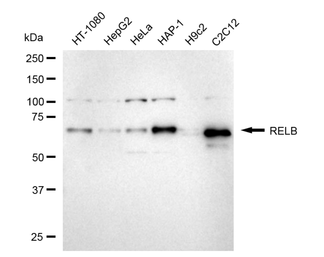 [KD Validated] Anti-RELB Rabbit mAb [20H12C30]