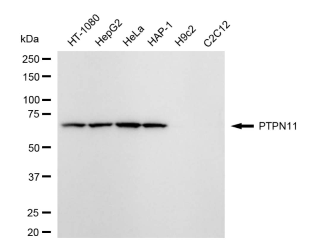 [KD Validated] Anti-PTPN11 Rabbit mAb [83T38D99]