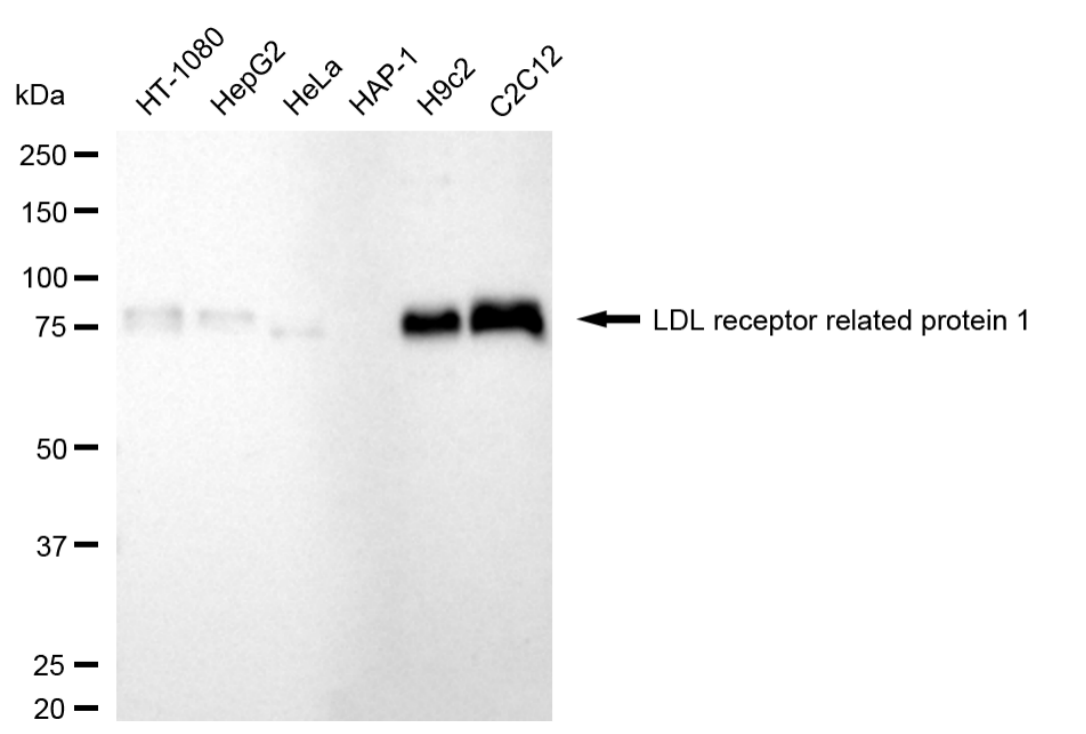 [KD Validated] Anti-LRP1 Rabbit mAb [59S81S22]