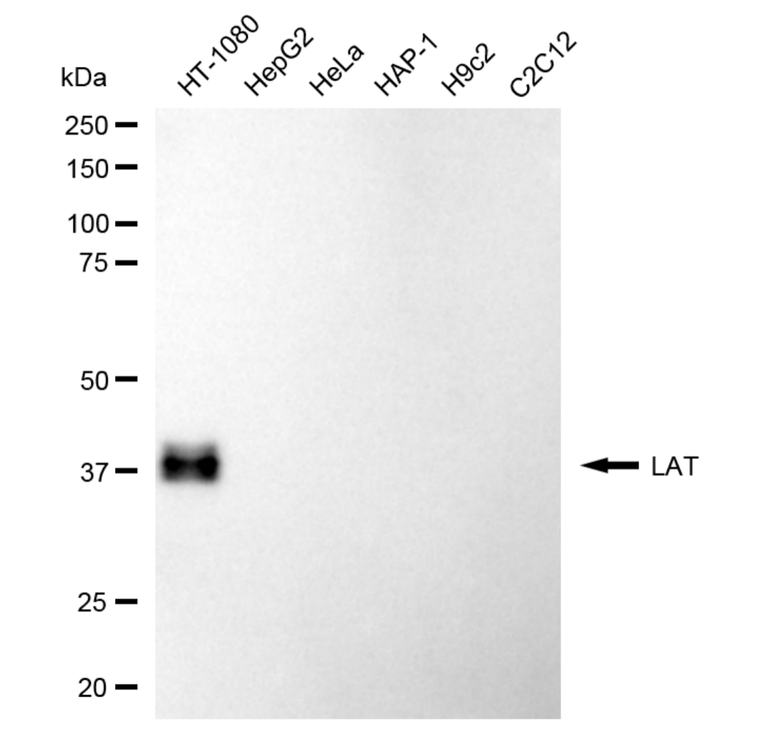 [KD Validated] Anti-LAT Rabbit mAb [50R44L59]