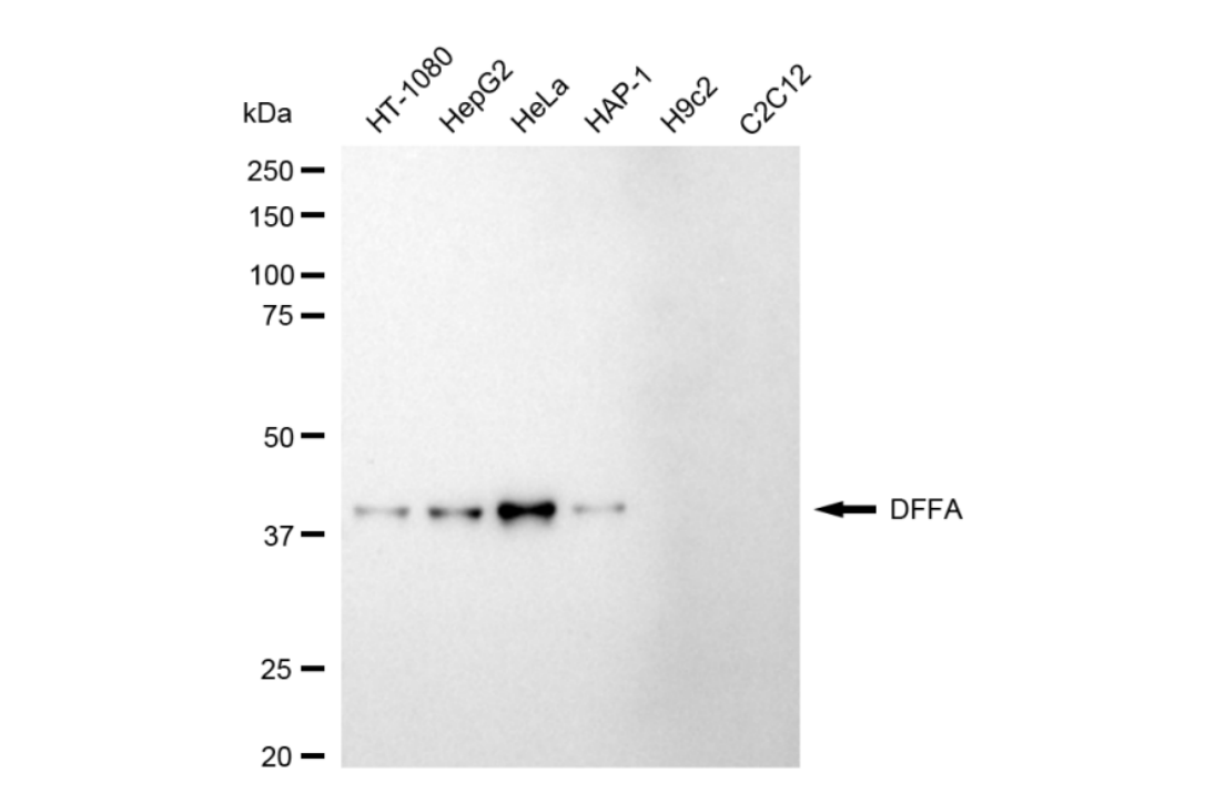 [KD Validated] Anti-DFFA Rabbit mAb [93G79T78]