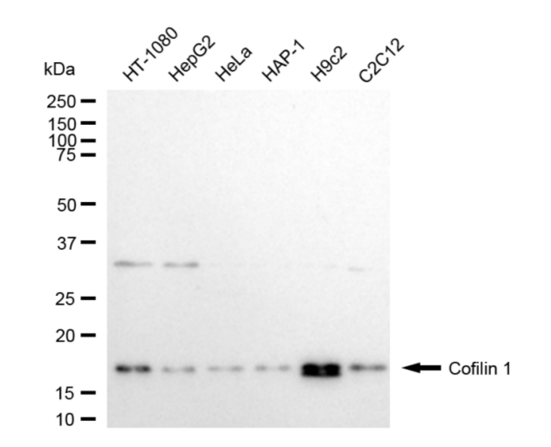 [KD Validated] Anti-CFL1 Rabbit mAb [21C99S85]