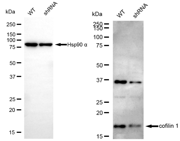 [KD Validated] Anti-CFL1 Rabbit mAb [21C99S85]