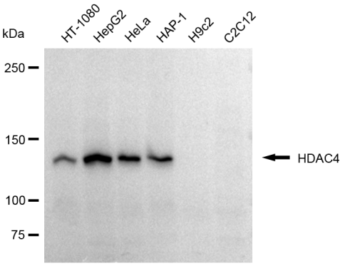 [KD Validated] Anti-HDAC4 Rabbit mAb [84B94Q32]