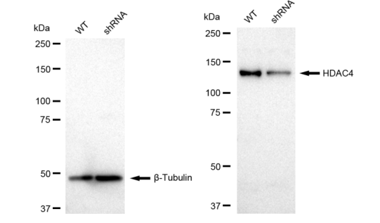 [KD Validated] Anti-HDAC4 Rabbit mAb [84B94Q32]