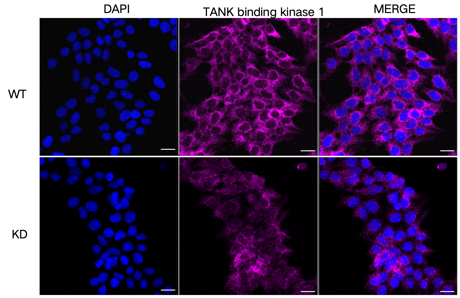 [KD Validated] Anti-TBK1 Rabbit mAb [17E54M68]