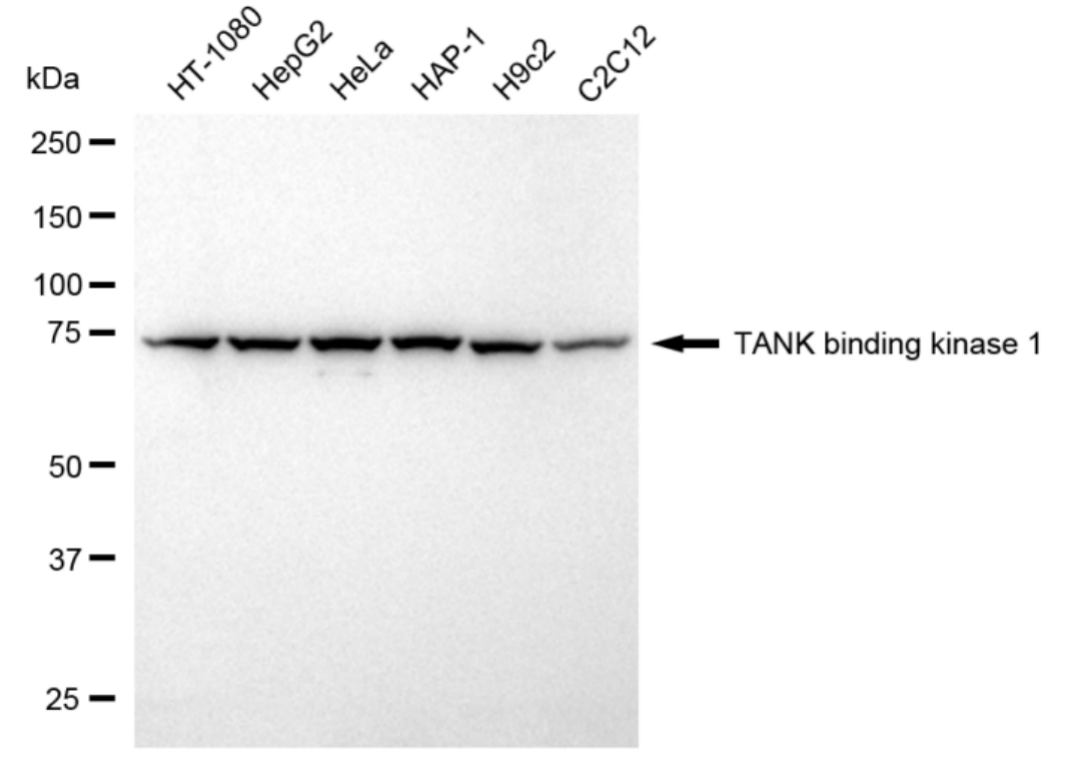 [KD Validated] Anti-TBK1 Rabbit mAb [17E54M68]