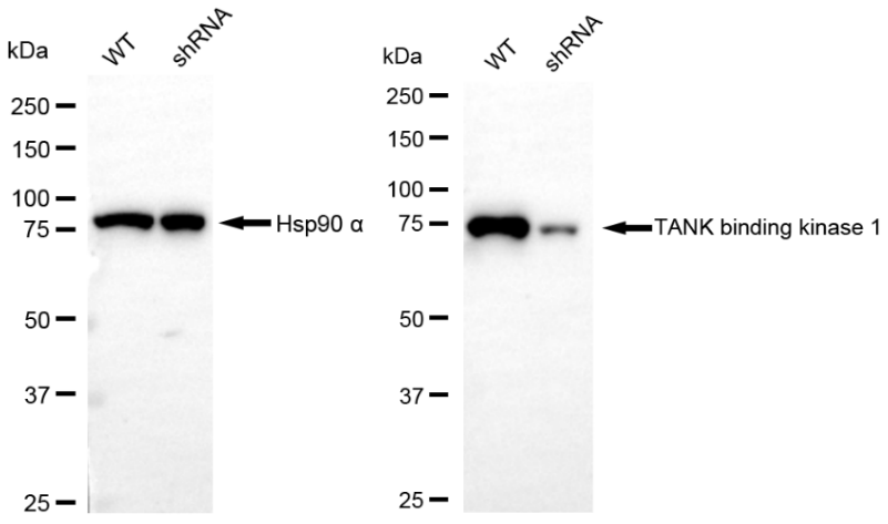 [KD Validated] Anti-TBK1 Rabbit mAb [17E54M68]