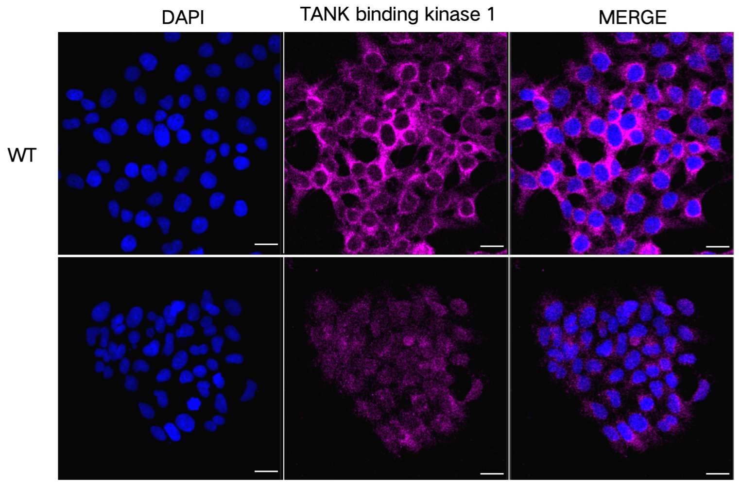 [KD Validated] Anti-TBK1 Rabbit mAb [79M94A45]
