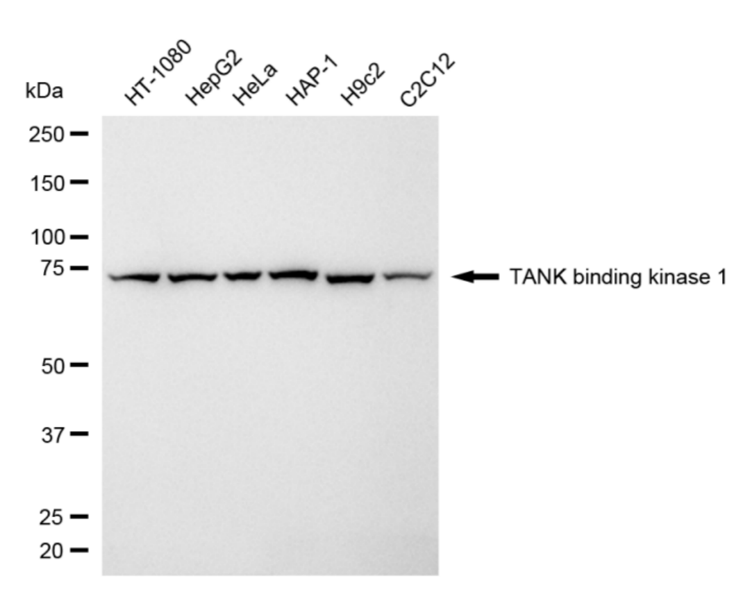 [KD Validated] Anti-TBK1 Rabbit mAb [79M94A45]