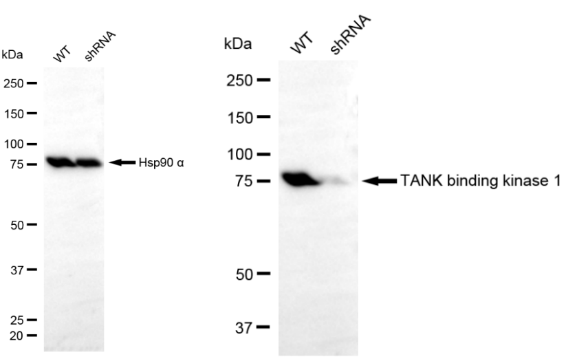 [KD Validated] Anti-TBK1 Rabbit mAb [79M94A45]