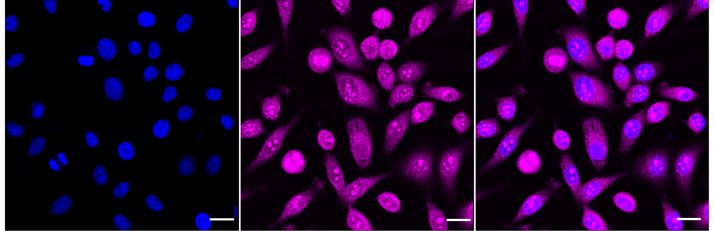 [KD Validated] Anti-TBK1 Rabbit mAb [72K29C17]