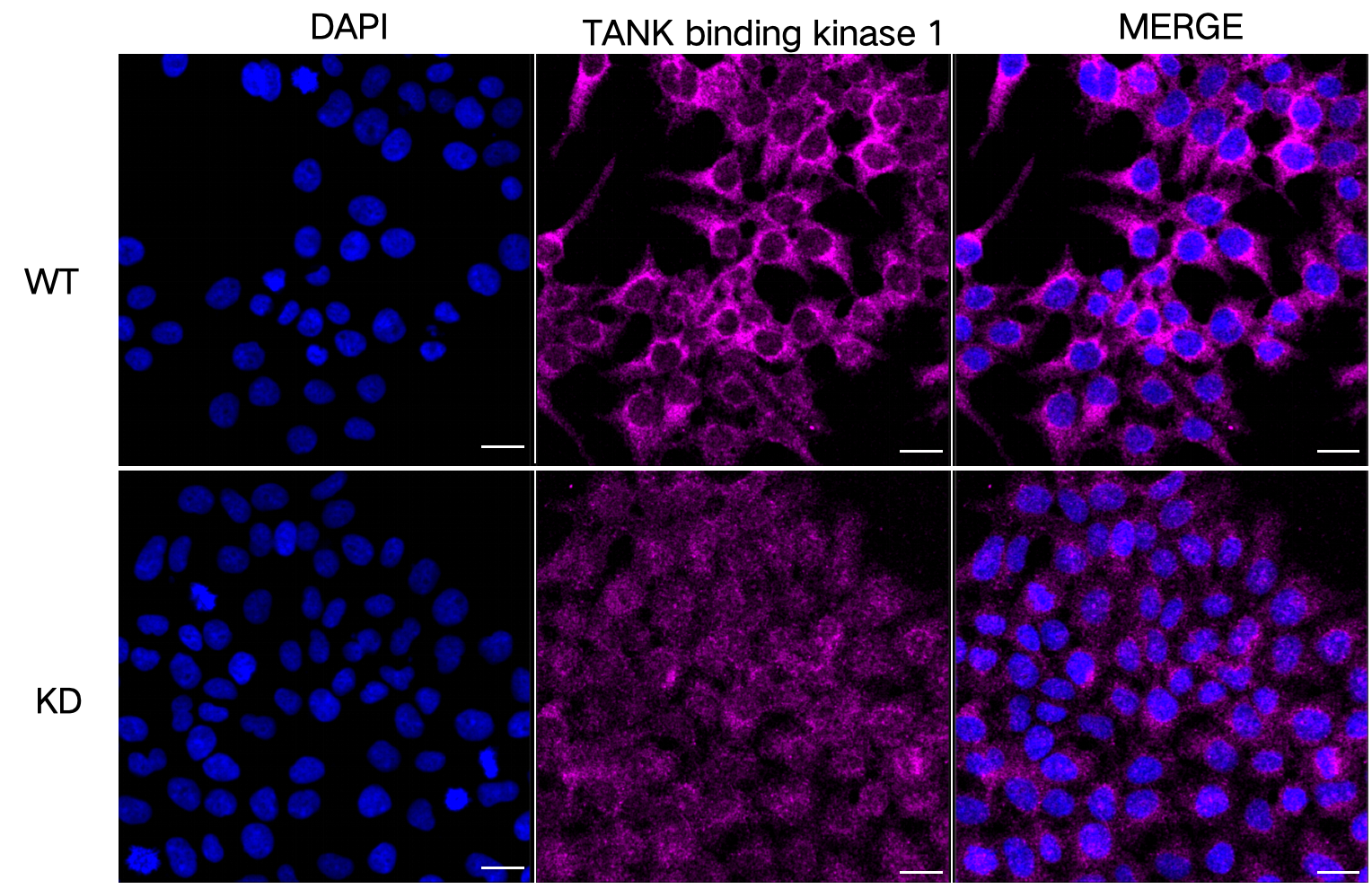 [KD Validated] Anti-TBK1 Rabbit mAb [72K29C17]