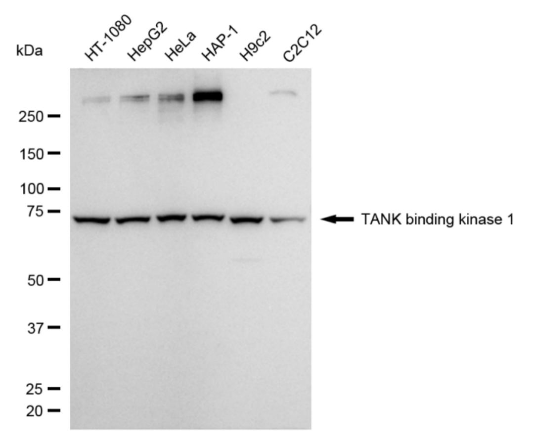 [KD Validated] Anti-TBK1 Rabbit mAb [72K29C17]
