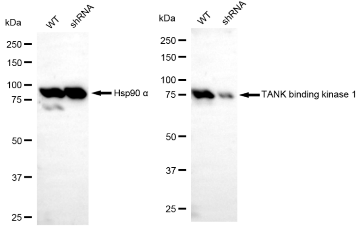 [KD Validated] Anti-TBK1 Rabbit mAb [72K29C17]