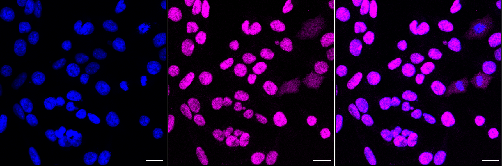 [KD Validated] Anti-CHEK2 Rabbit mAb [44L69H30]