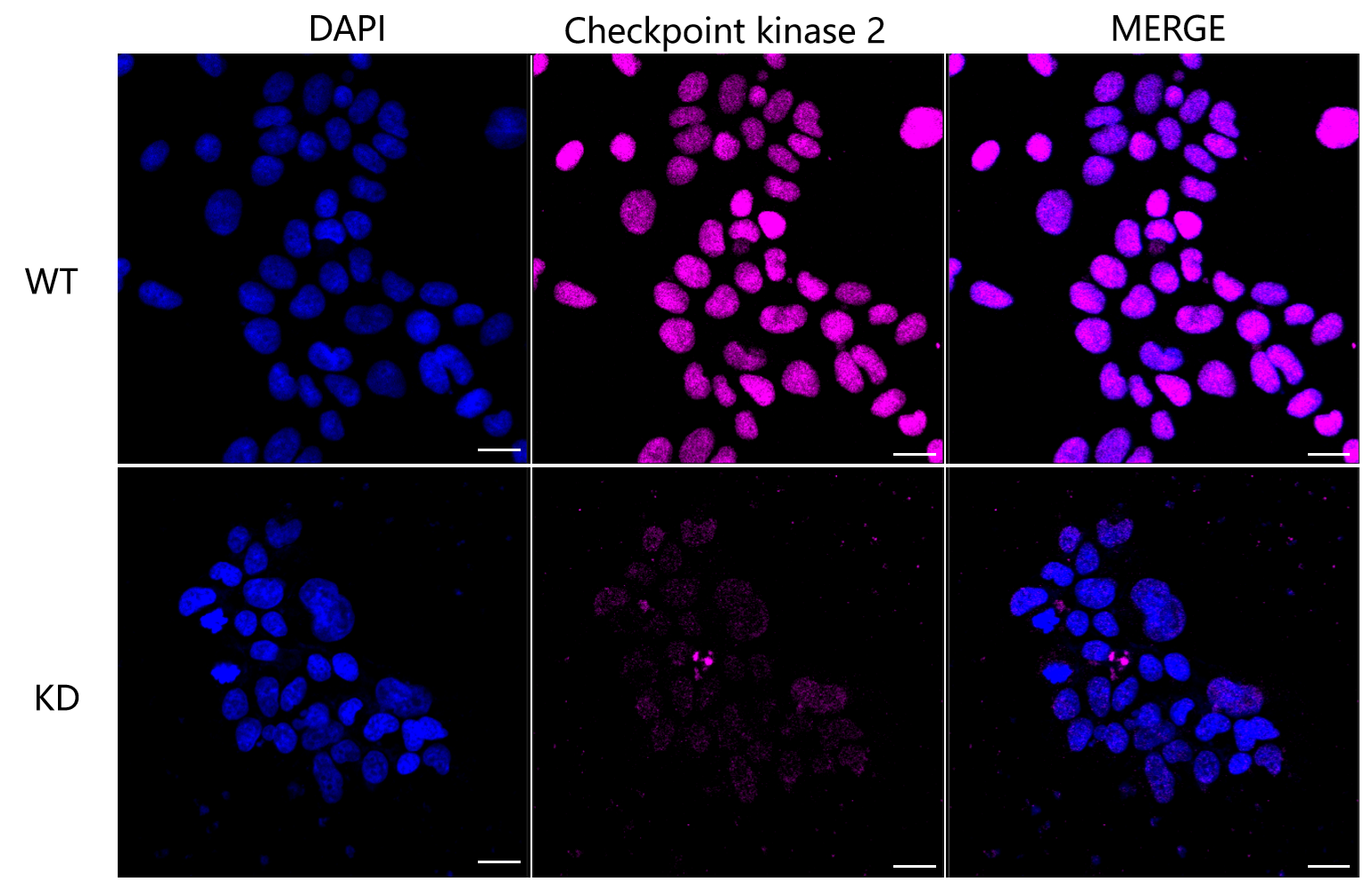 [KD Validated] Anti-CHEK2 Rabbit mAb [44L69H30]